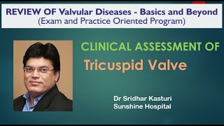 Clinical assessment of Tricuspid Valve Diseases Dr Vamshi Krishna [upl. by Atteuqahs]