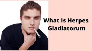 What Is Herpes Gladiatorum [upl. by Augusto]