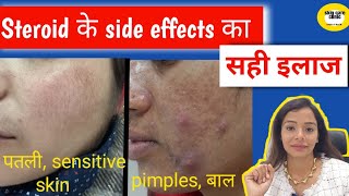 स्टेरॉयड क्रीम से चेहरा ख़राब l steroids ke side effect ko kaise thik kare [upl. by Absalom]