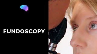 Fundoscopy Ophthalmoscopy  OSCE Guide  UKMLA  CPSA [upl. by Dorca661]