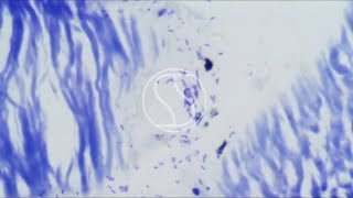 Helicobacter pylori under the microscope with Toluidine Blue stain [upl. by Adnic442]