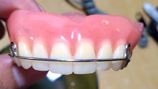 Pustiso with Retainer or Denture with Retainer [upl. by Ecinrev]