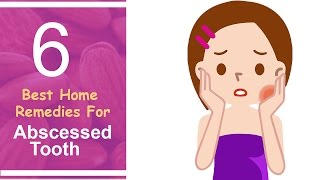 6 Best Home Remedies For Abscessed Tooth [upl. by Arual863]