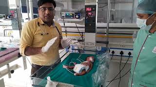 NRP Part8 I Special circumstances I Neonatal Resuscitation I Neonatologist I NICU [upl. by Hoskinson]