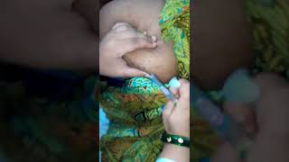 Injection vlog  Injection lagane ka sahi tarika  Intramuscular Injection vlog  Injection video [upl. by Ferdy]