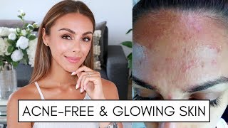 HOW I MAINTAIN ACNEFREE GLOWING HEALTHY SKIN  Annie Jaffrey [upl. by Foah]