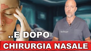 Dopo la chirurgia endoscopica nasale [upl. by Adnawad820]