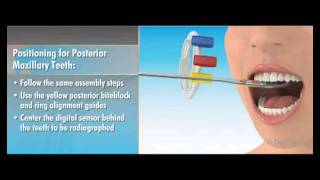 Dentsply Rinn XCPDS FIT Dentrek Module [upl. by Engeddi780]