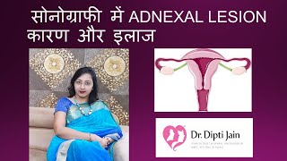 सोनोग्राफी में ADNEXAL LESION कारण और इलाज [upl. by Kimber968]