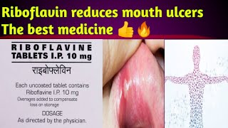 Riboflavin tablet uses and side effects in teluguBest medicine for mouth ulcers [upl. by Erhard870]