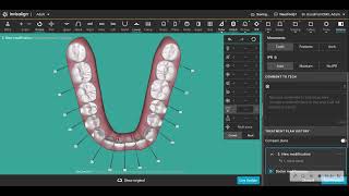 Overcorrection in your clincehck might be Overrated [upl. by Aninay]