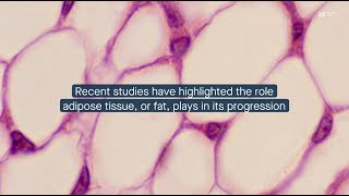 How hormone changes influence prostate cancer through adipose tissue [upl. by Salta]