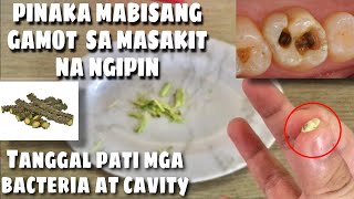 MABISANG GAMOT SA SAKIT NG NGIPIN  SUPER EFFECTIVE AND SAFE  Jery Napare [upl. by Llebiram151]