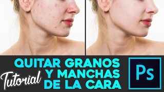 Photoshop CC  Quitar granos y manchas de la piel  Tutorial Español [upl. by Walworth514]