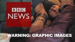 BBC goes undercover inside Americas heroin epidemic  BBC News [upl. by Shanley573]