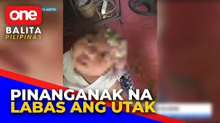 Anencephalic baby nabuhay lang sa loob ng 24 araw [upl. by Kery83]