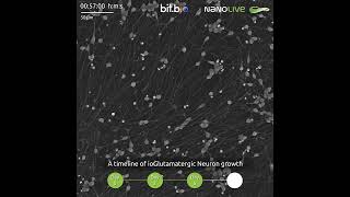 A timeline of ioGlutamateric Neurons [upl. by Nodnahs935]