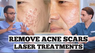 Erase Your Acne Scarring  How To Remove Acne Scars With LASERS  Dr Somji amp Dr Solomon discuss [upl. by Uball]