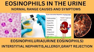 EOSINOPHILS IN URINENORMAL RANGE CAUSES OF EOSINOPHILS IN URINELYMPHOCYTES MONOCYTES IN URINE [upl. by Kendell]