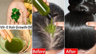 I Put👆🏼This Hair Growth Oil Daily on Hair Loss Areas amp ScalpGot Double Hair DensityThickLong Hair [upl. by Moguel]