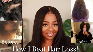 From BALDING To WAIST LENGTH Fighting And BEATING Alopecia  Plus Hair Goal Tips [upl. by Leunamne410]