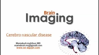 Imaging of cerebrovascular disease DRE Prof Mamdouh Mahfouz [upl. by Wallache]