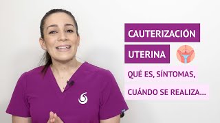 ¿Qué es la cauterización del cuello del útero y cuándo se realiza [upl. by Deidre]