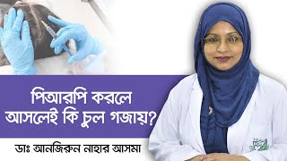 PRP treatment for hair loss  Hair loss treatment  Hair transplant  Health Tips Bangla  পিআরপি [upl. by Hanford]