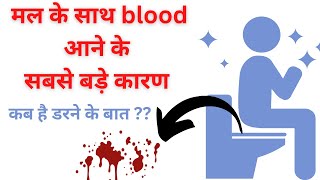 latrine या मल के साथ ब्लड आने के 7 सबसे बड़े कारण  मल में खून आना कब होता है खरतनाक [upl. by Enaxor817]