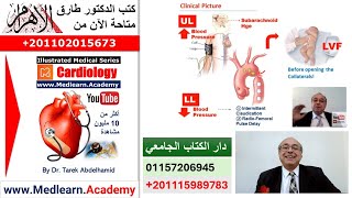 COARCTATION OF AORTA  Pediatrics  Causes  Pathophysiology  Symptoms  The Nures Station [upl. by Aderb]