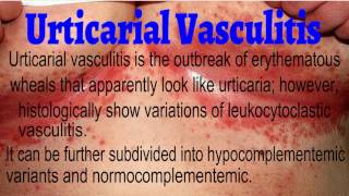 Urticarial Vasculitis  Hypocomplementemic Urticarial Vasculitis [upl. by Ahcirt]