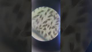 bacterial under microscope 🔬 [upl. by Fanchie987]