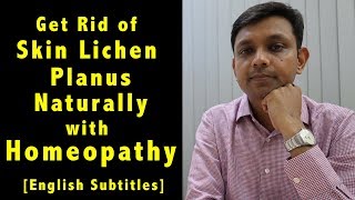 How to Get Rid of Skin Lichen Planus Naturally with Homeopathy amp Home Remedies amp Diet Tips [upl. by Atsilac]