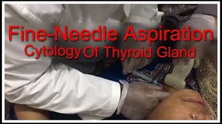 Fine Needle Aspiration Cytology Thyroid Gland  Urdu  Hindi [upl. by Gnah]