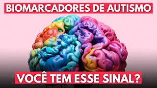 TOP 5 POSSÍVEIS BIOMARCADORES DE AUTISMO 2023 [upl. by Anaigroeg960]