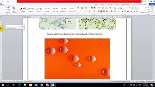 Nonsporeforming Gram positive Bacteria [upl. by Kat]