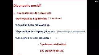 démarche diagnostique devant une adénopathie [upl. by Odrick32]