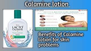 CALAMINE LOTION USES IN HINDI [upl. by Ansilme508]