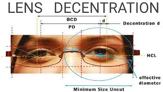 Lens Decentration  AK Khurana  Dr Saud Javed [upl. by Torbart]