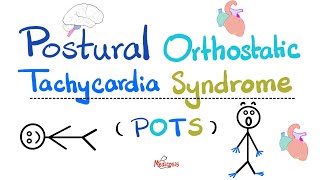 Postural Orthostatic Tachycardia Syndrome POTS  Causes Symptoms Diagnosis TreatmentCardiology [upl. by Ziagos101]