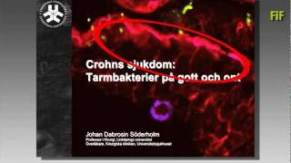 Crohns sjukdom  tarmbakterier på gott och ont [upl. by Harifaz]