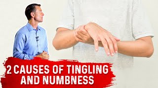 What Causes Tingling amp Numbness in Hands amp Feet – Dr Berg [upl. by Pauly]