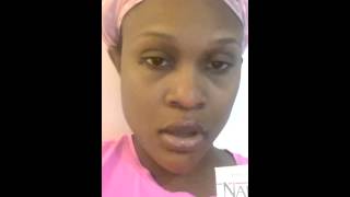 NADINOLA FADE CREAM For DarkSPOTS [upl. by Theresa]