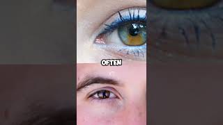 Why do some people have Heterochromia facts science y heterochromia eyecolor didyouknow [upl. by Cilurzo293]