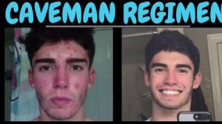 Caveman Regimen Cured My Cystic Acne  No skincare products to clear your skin [upl. by Keynes557]