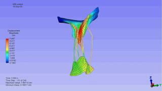 Finite element model of a mitral valve [upl. by Savadove852]