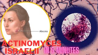 actinomyces microbiology lecture actinomyces israelii Easy Microbiology [upl. by Abrahams825]