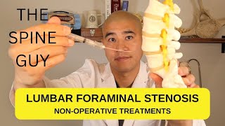 Lumbar Foraminal Stenosis  Non Operative Treatments [upl. by Llien565]