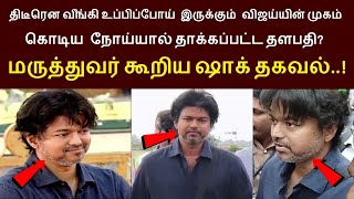 திடீரென வீங்கி உப்பிப்போய் இருக்கும் விஜய்யின் முகம் என்ன காரணம் மருத்துவர் கூறிய ஷாக் தகவல் [upl. by Ecinom326]