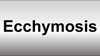 How to Pronounce Ecchymosis [upl. by Meekah]